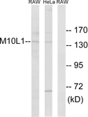 Anti-MOV10L1 antibody used in Western Blot (WB). GTX87827