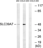 Anti-SLC39A7 antibody used in Western Blot (WB). GTX87830