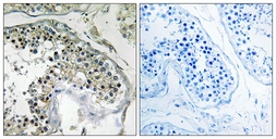 Anti-PPP1R1C antibody used in IHC (Paraffin sections) (IHC-P). GTX87861