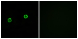 Anti-ACOT4 antibody used in Immunocytochemistry/ Immunofluorescence (ICC/IF). GTX87881