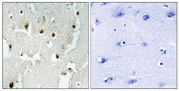 Anti-TReP132 antibody used in IHC (Paraffin sections) (IHC-P). GTX87884