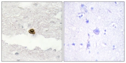 Anti-DGKZ antibody used in IHC (Paraffin sections) (IHC-P). GTX87908