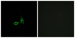 Anti-CDH24 antibody used in Immunocytochemistry/ Immunofluorescence (ICC/IF). GTX87920