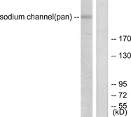 Anti-Sodium Channel-pan antibody used in Western Blot (WB). GTX87930