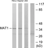 Anti-MNAT1 antibody used in Western Blot (WB). GTX87969