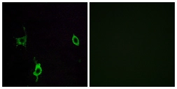 Anti-LAMC3 antibody used in Immunocytochemistry/ Immunofluorescence (ICC/IF). GTX87972
