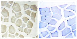 Anti-NKIAMRE antibody used in IHC (Paraffin sections) (IHC-P). GTX87990