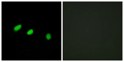 Anti-TRA-2 alpha antibody used in Immunocytochemistry/ Immunofluorescence (ICC/IF). GTX87998