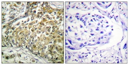Anti-p53 (acetyl Lys379) antibody used in IHC (Paraffin sections) (IHC-P). GTX88013