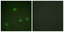 Anti-Histone H3K23ac (Acetyl Lys23) antibody used in Immunocytochemistry/ Immunofluorescence (ICC/IF). GTX88017