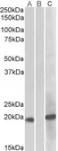 Anti-HOXA1 antibody, Internal used in Western Blot (WB). GTX88041