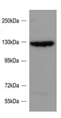 Anti-SRGAP2 antibody, Internal used in Western Blot (WB). GTX88045