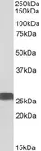Anti-PGP9.5 antibody, Internal used in Western Blot (WB). GTX88056