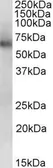 Anti-ALDH1B1 antibody, Internal used in Western Blot (WB). GTX88077