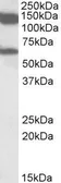 Anti-AF10 antibody, Internal used in Western Blot (WB). GTX88120
