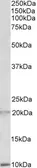 Anti-DEFA1/3 precursor antibody, Internal used in Western Blot (WB). GTX88155