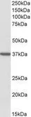 Anti-TOMM40 antibody, Internal used in Western Blot (WB). GTX88159