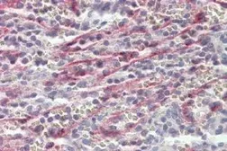 Anti-Stabilin 1 antibody, C-term used in IHC (Paraffin sections) (IHC-P). GTX88184