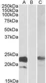 Anti-Cystatin 8 (aa 23-34) antibody, Internal used in Western Blot (WB). GTX88202