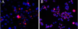 Anti-CEP290 antibody, Internal used in Immunocytochemistry/ Immunofluorescence (ICC/IF). GTX88258