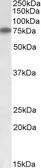 Anti-Arginyl tRNA synthetase antibody, Internal used in Western Blot (WB). GTX88260