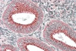 Anti-SNX1 antibody, Internal used in IHC (Paraffin sections) (IHC-P). GTX88278