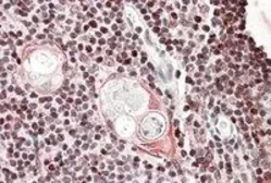Anti-SATB1 antibody, Internal used in IHC (Paraffin sections) (IHC-P). GTX88290