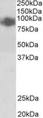 Anti-Blimp1 antibody, Internal used in Western Blot (WB). GTX88296