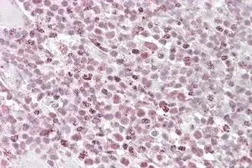 Anti-Ikaros antibody, Internal used in IHC (Paraffin sections) (IHC-P). GTX88298