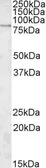 Anti-SGSM3 antibody, Internal used in Western Blot (WB). GTX88368
