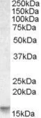 Anti-Noxa antibody, Internal used in Western Blot (WB). GTX88398