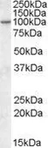 Anti-CENTG1 antibody, Internal used in Western Blot (WB). GTX88422