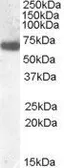Anti-GCKR antibody, N-term used in Western Blot (WB). GTX88432