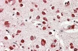 Anti-LIMP II antibody, Internal used in IHC (Paraffin sections) (IHC-P). GTX88440