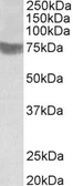 Anti-TRC8 antibody, C-term used in Western Blot (WB). GTX88450