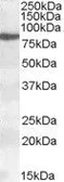 Anti-ALOX15 antibody, Internal used in Western Blot (WB). GTX88501
