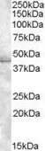 Anti-Muscleblind-like 1 antibody, C-term used in Western Blot (WB). GTX88502