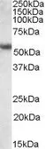 Anti-Cytokeratin 13 antibody, C-term used in Western Blot (WB). GTX88529