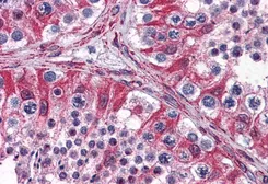 Anti-PACE4 antibody, Internal used in IHC (Paraffin sections) (IHC-P). GTX88546