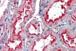 Anti-APOBEC3G antibody, C-term used in IHC (Paraffin sections) (IHC-P). GTX88548