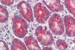 Anti-CLCA1 (aa872-884) antibody, Internal used in IHC (Paraffin sections) (IHC-P). GTX88552
