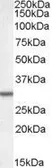 Anti-Dpm1 antibody, N-term used in Western Blot (WB). GTX88561