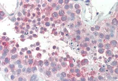 Anti-MARCH10 antibody, Internal used in IHC (Paraffin sections) (IHC-P). GTX88596