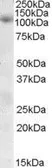 Anti-SNX19 antibody, Internal used in Western Blot (WB). GTX88598