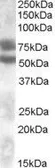 Anti-DACH1 antibody, Internal used in Western Blot (WB). GTX88629