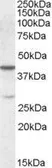 Anti-CBX8 antibody, Internal used in Western Blot (WB). GTX88655