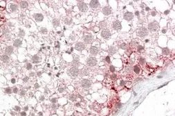 Anti-PMP70 antibody, Internal used in IHC (Paraffin sections) (IHC-P). GTX88667