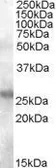 Anti-AICDA antibody, N-term used in Western Blot (WB). GTX88708
