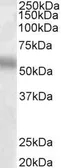 Anti-TFEB antibody, Internal used in Western Blot (WB). GTX88723