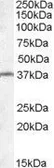 Anti-TSGA2 antibody, Internal used in Western Blot (WB). GTX88743